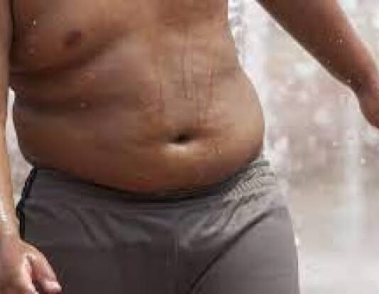 Transforming Life Beyond Obesity