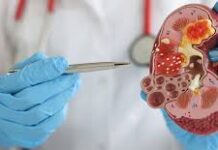 Kenya Named in Global Organ Trafficking Network as Eldoret Hospital Implicated